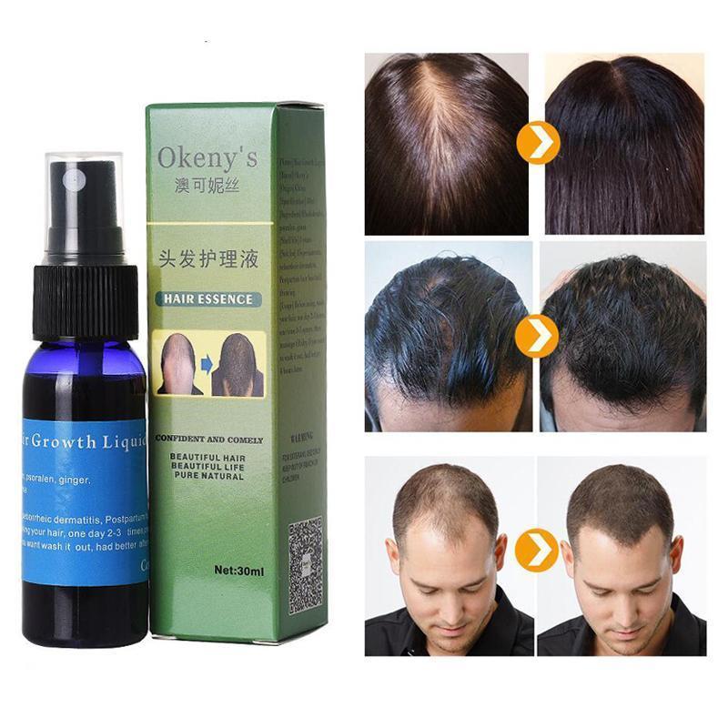 Sunburst Hair Growth Products for women & men anti-hair loss products Alopecia Baldness beard oil growth Hair growth spray