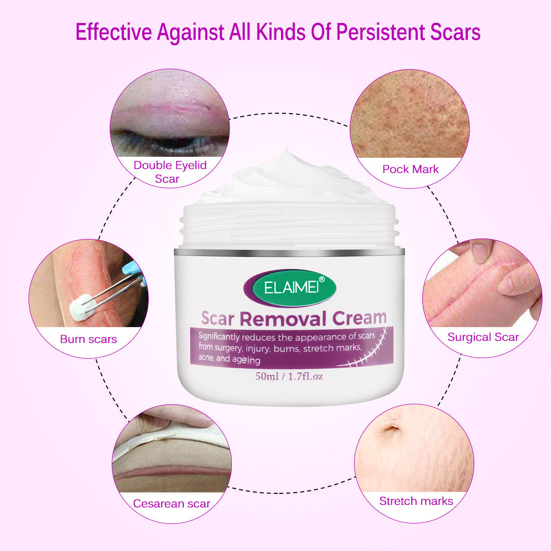 Skin Rebound Scarless Cream Scar Removal Cream Face Cream For Face Acne Scar Stretch Marks Skin Repair Face Cream