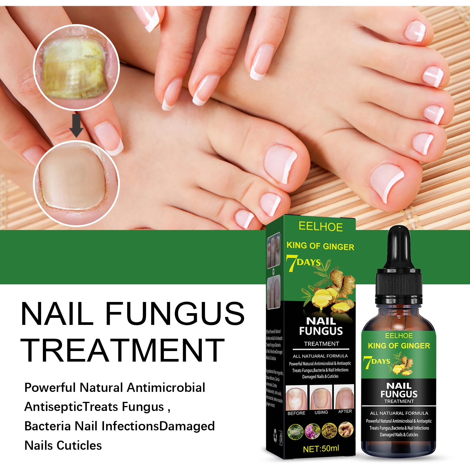 Nail Repair Solution( Hand Foot And Nail Care Solution)